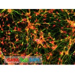 Human Cortical GABAergic Neurons (iPSC-derived, Normal)